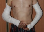 vazoun